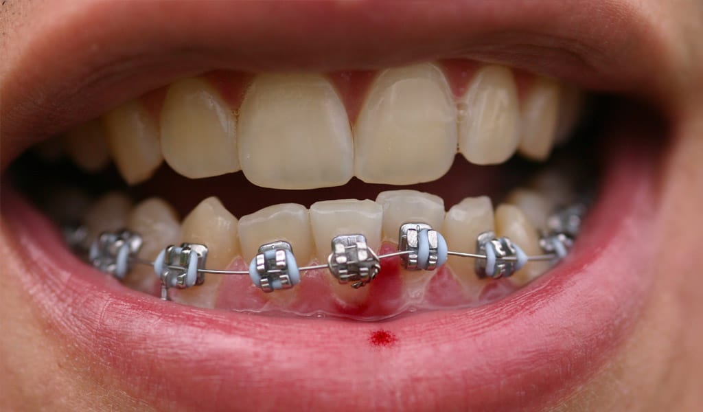 urgencias dentales en Valencia