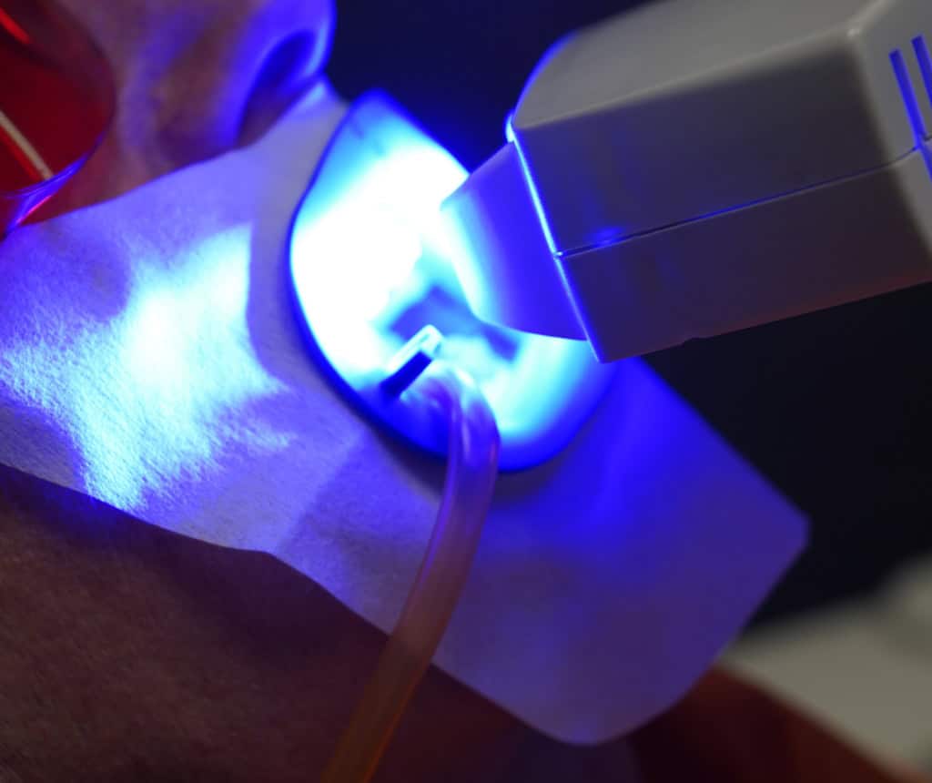 El blanqueamiento dental en Puerto de Sagunto es uno de los tratamientos de estética dental más demandados por quienes quieren mejorar el tono de sus dientes y conseguir una sonrisa más luminosa sin modificar su forma.