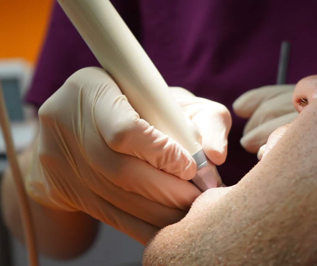 Tratamiento dental en Albalat Dental