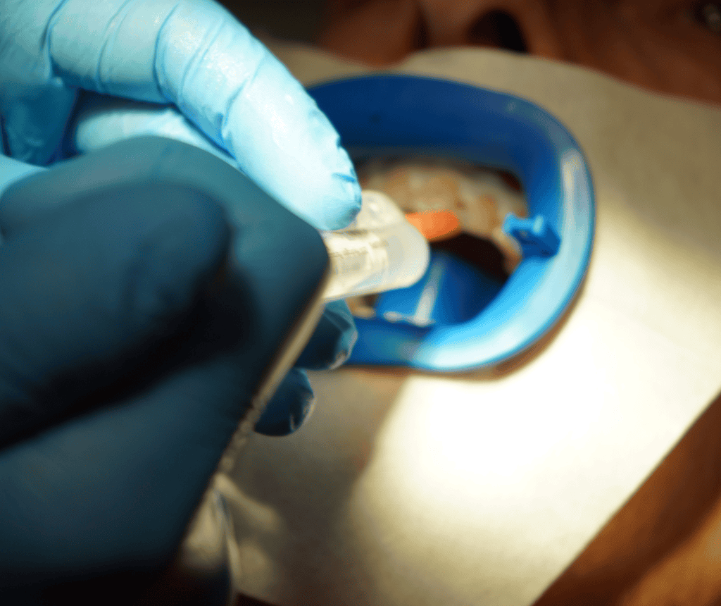 Tratamiento de estética dental