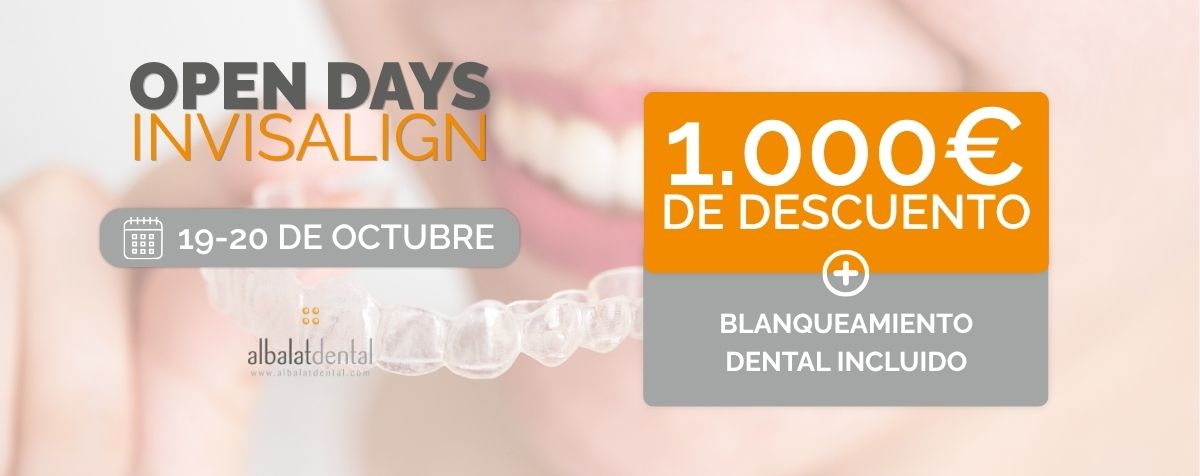 Open Days en Invisalign